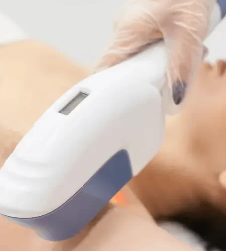 Depilacao a Laser