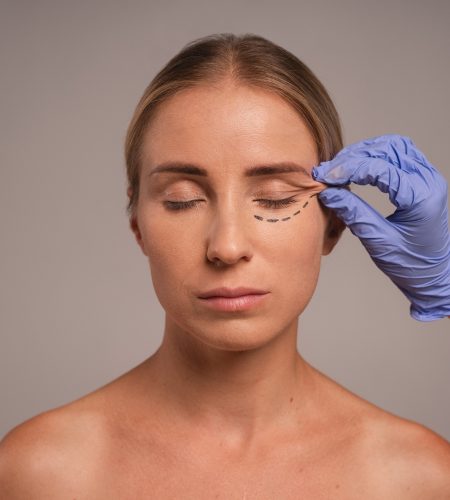 Blefaroplastia não cirurgica